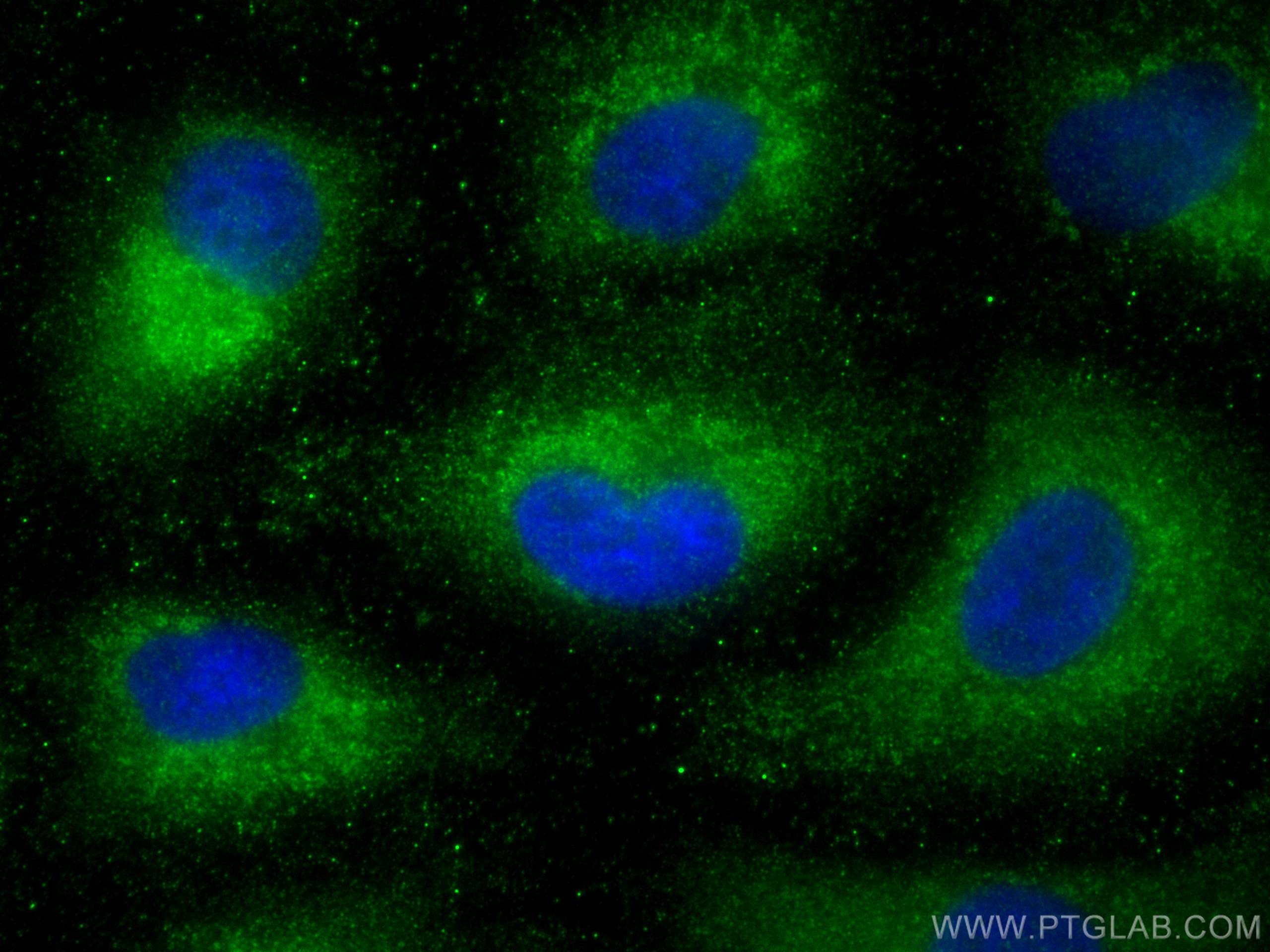 IF Staining of A549 using 12632-1-AP