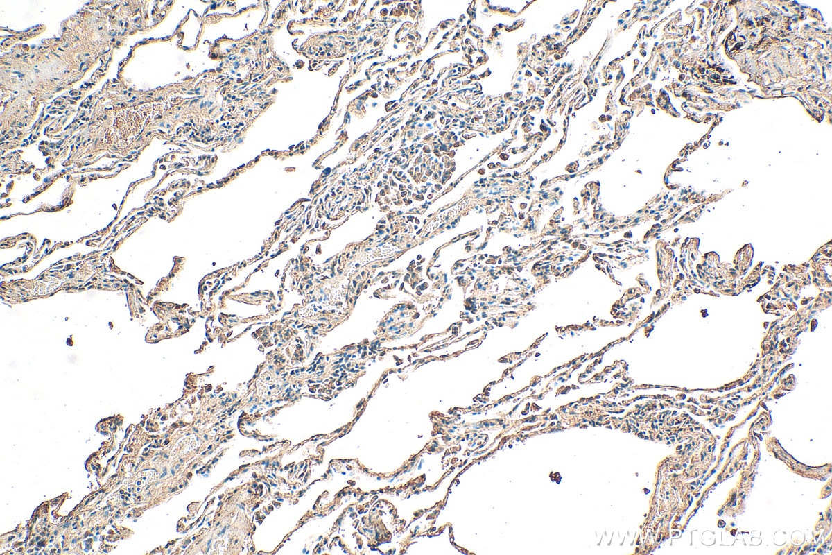 Immunohistochemistry (IHC) staining of human lung tissue using LAMP3 Polyclonal antibody (12632-1-AP)