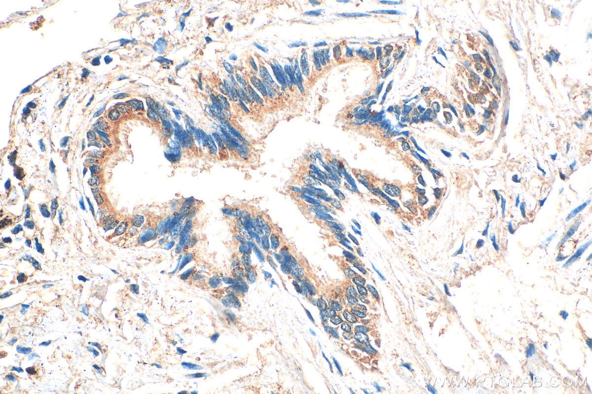 Immunohistochemistry (IHC) staining of human lung tissue using LAMP3 Polyclonal antibody (12632-1-AP)