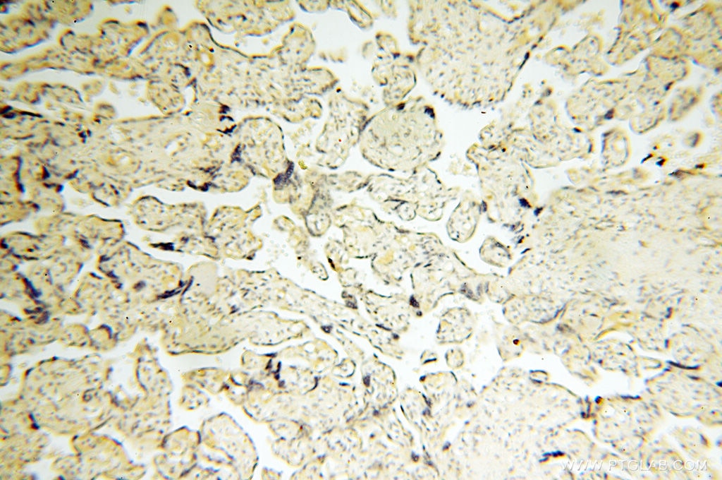 Immunohistochemistry (IHC) staining of human placenta tissue using LAMP3 Polyclonal antibody (12632-1-AP)