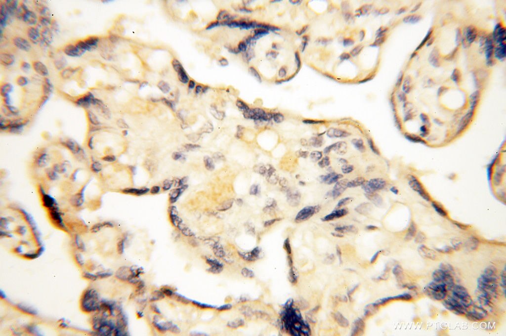 Immunohistochemistry (IHC) staining of human placenta tissue using LAMP3 Polyclonal antibody (12632-1-AP)