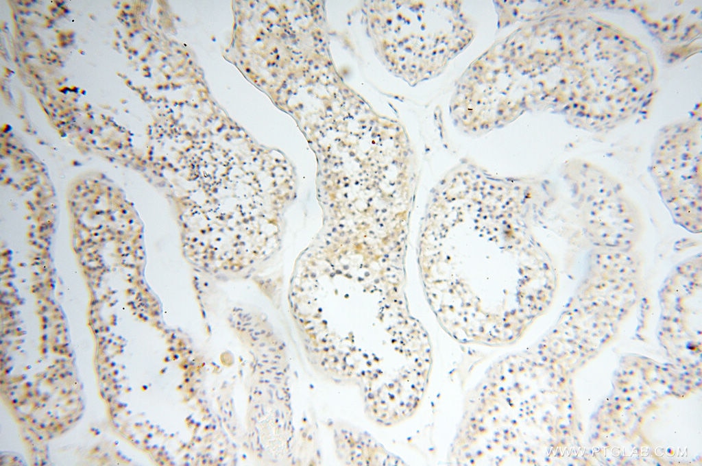 IHC staining of human testis using 12632-1-AP