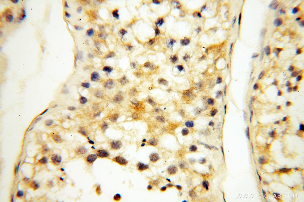 Immunohistochemistry (IHC) staining of human testis tissue using LAMP3 Polyclonal antibody (12632-1-AP)