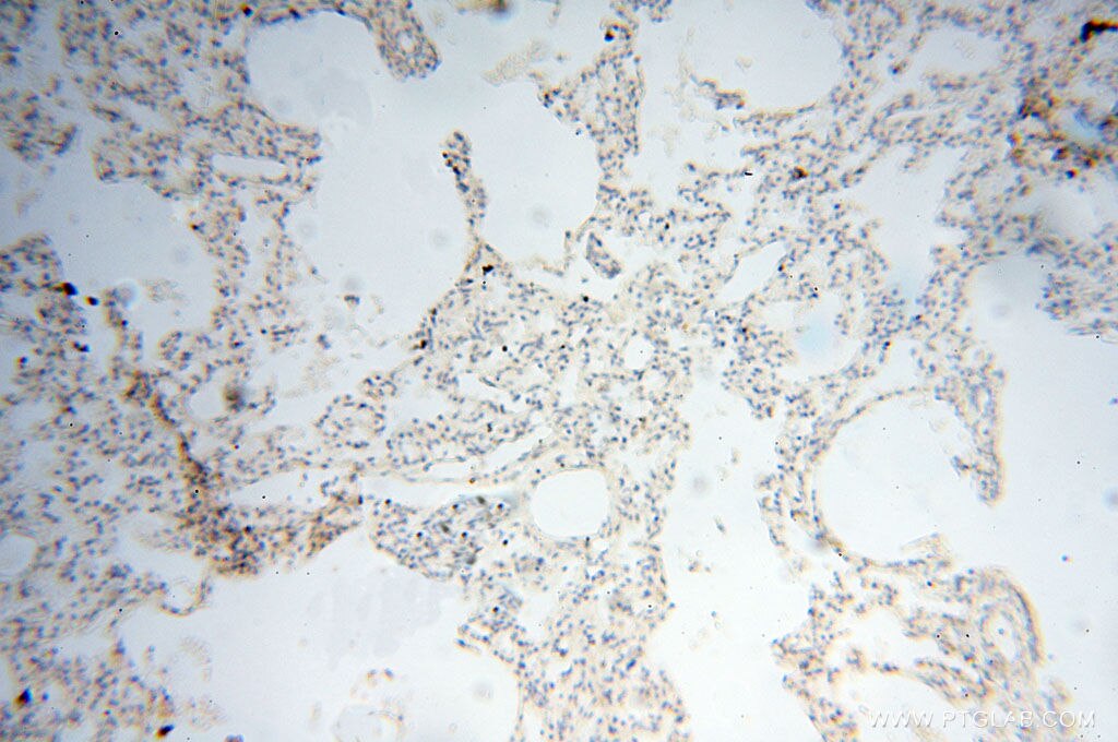 Immunohistochemistry (IHC) staining of human lung tissue using LAMP3 Polyclonal antibody (12632-1-AP)