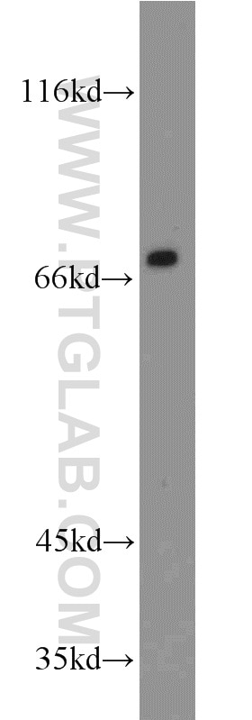Western Blot (WB) analysis of A375 cells using LAMP3 Polyclonal antibody (12632-1-AP)