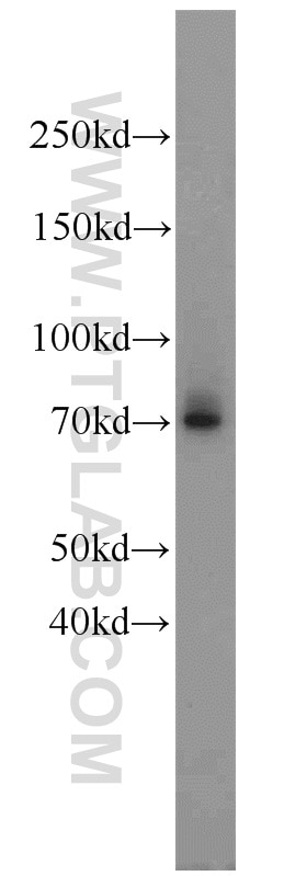 Western Blot (WB) analysis of rat lung tissue using LAMP3 Polyclonal antibody (12632-1-AP)