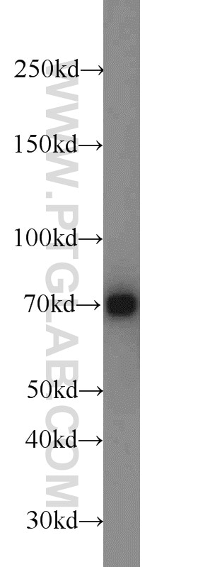 Western Blot (WB) analysis of A549 cells using LAMP3 Polyclonal antibody (12632-1-AP)