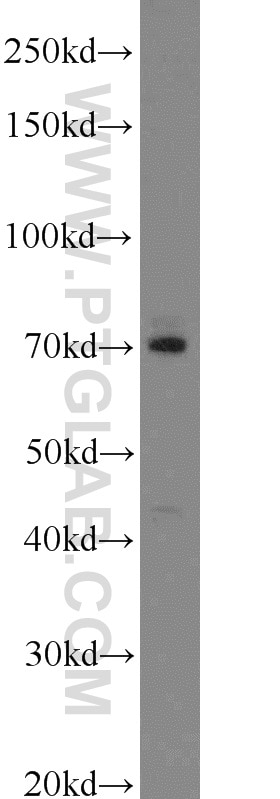 Western Blot (WB) analysis of mouse lung tissue using LAMP3 Polyclonal antibody (12632-1-AP)