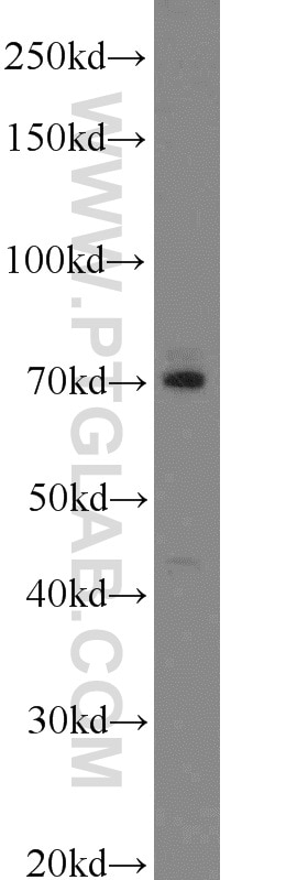 WB analysis of mouse lung using 12632-1-AP