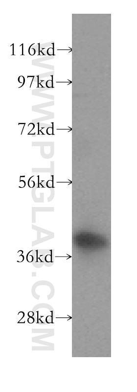 LAMR1,RPSA