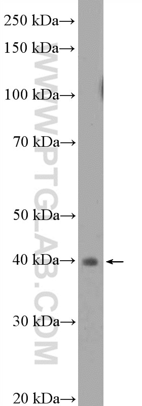 Western Blot (WB) analysis of mouse colon tissue using LAMR1,RPSA Polyclonal antibody (14533-1-AP)
