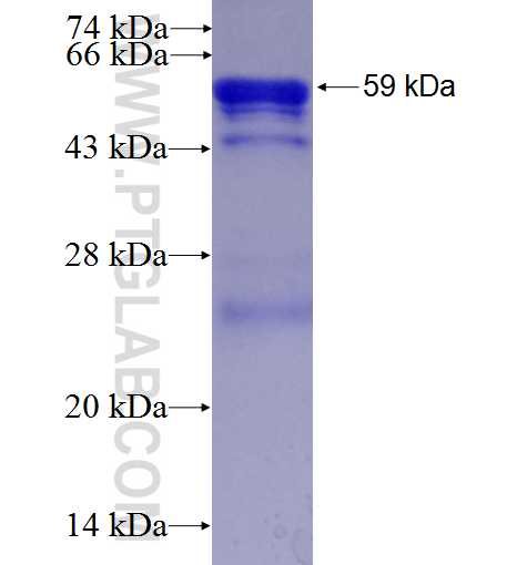 LAMR1,RPSA fusion protein Ag6033 SDS-PAGE