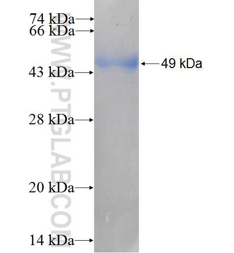 LAMR1,RPSA fusion protein Ag6190 SDS-PAGE
