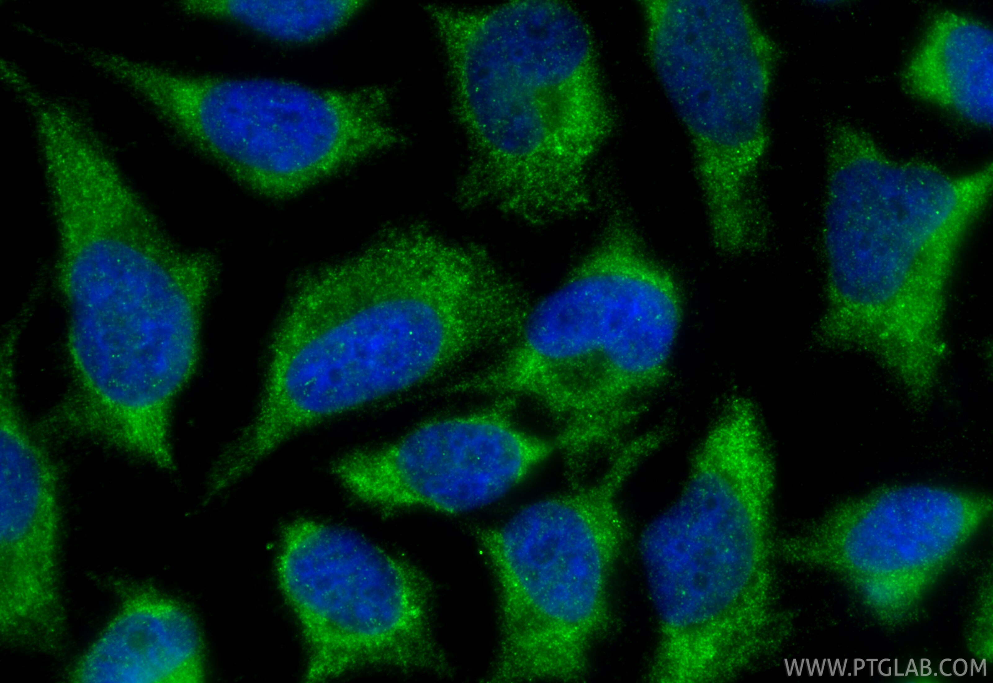 Immunofluorescence (IF) / fluorescent staining of HeLa cells using LAP3 Polyclonal antibody (14612-1-AP)