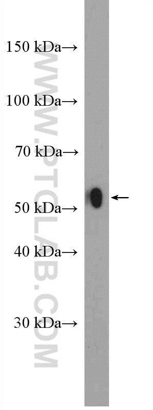 Western Blot (WB) analysis of mouse lung tissue using LAP3 Polyclonal antibody (14612-1-AP)