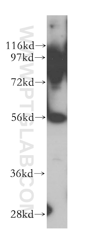 Western Blot (WB) analysis of HepG2 cells using LAP3 Polyclonal antibody (14612-1-AP)