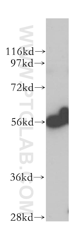 Western Blot (WB) analysis of SH-SY5Y cells using LAP3 Polyclonal antibody (14612-1-AP)