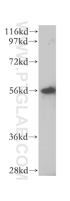 Western Blot (WB) analysis of HeLa cells using LAP3 Polyclonal antibody (14612-1-AP)