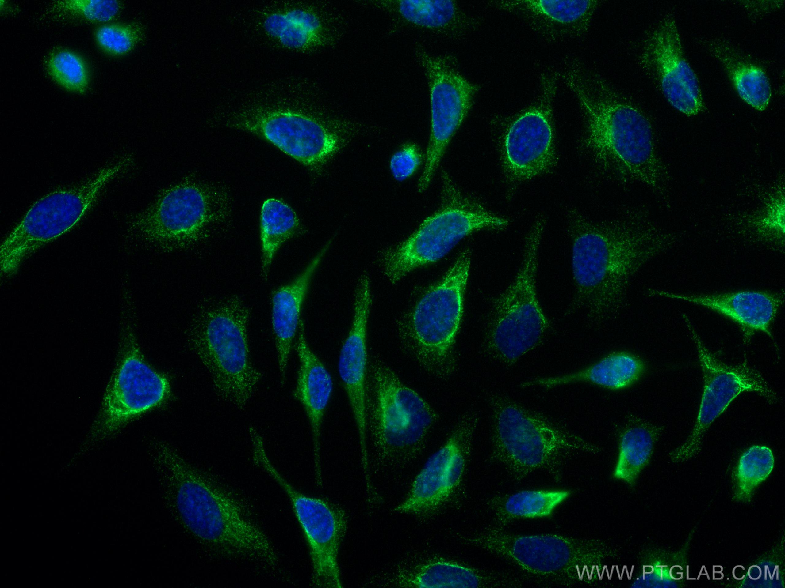 Immunofluorescence (IF) / fluorescent staining of HeLa cells using LAP3 Monoclonal antibody (66417-1-Ig)