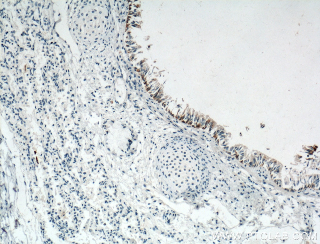Immunohistochemistry (IHC) staining of human lung tissue using LAP3 Monoclonal antibody (66417-1-Ig)