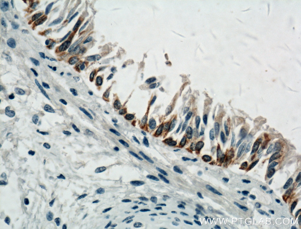 Immunohistochemistry (IHC) staining of human lung tissue using LAP3 Monoclonal antibody (66417-1-Ig)