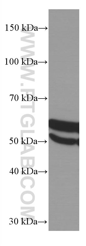 Western Blot (WB) analysis of HeLa cells using LAP3 Monoclonal antibody (66417-1-Ig)
