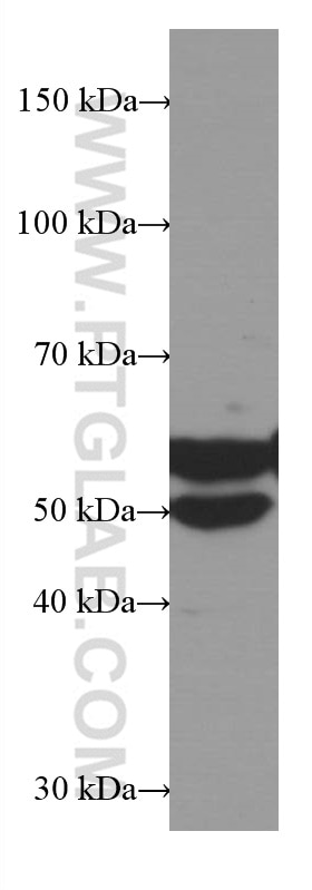 Western Blot (WB) analysis of HepG2 cells using LAP3 Monoclonal antibody (66417-1-Ig)