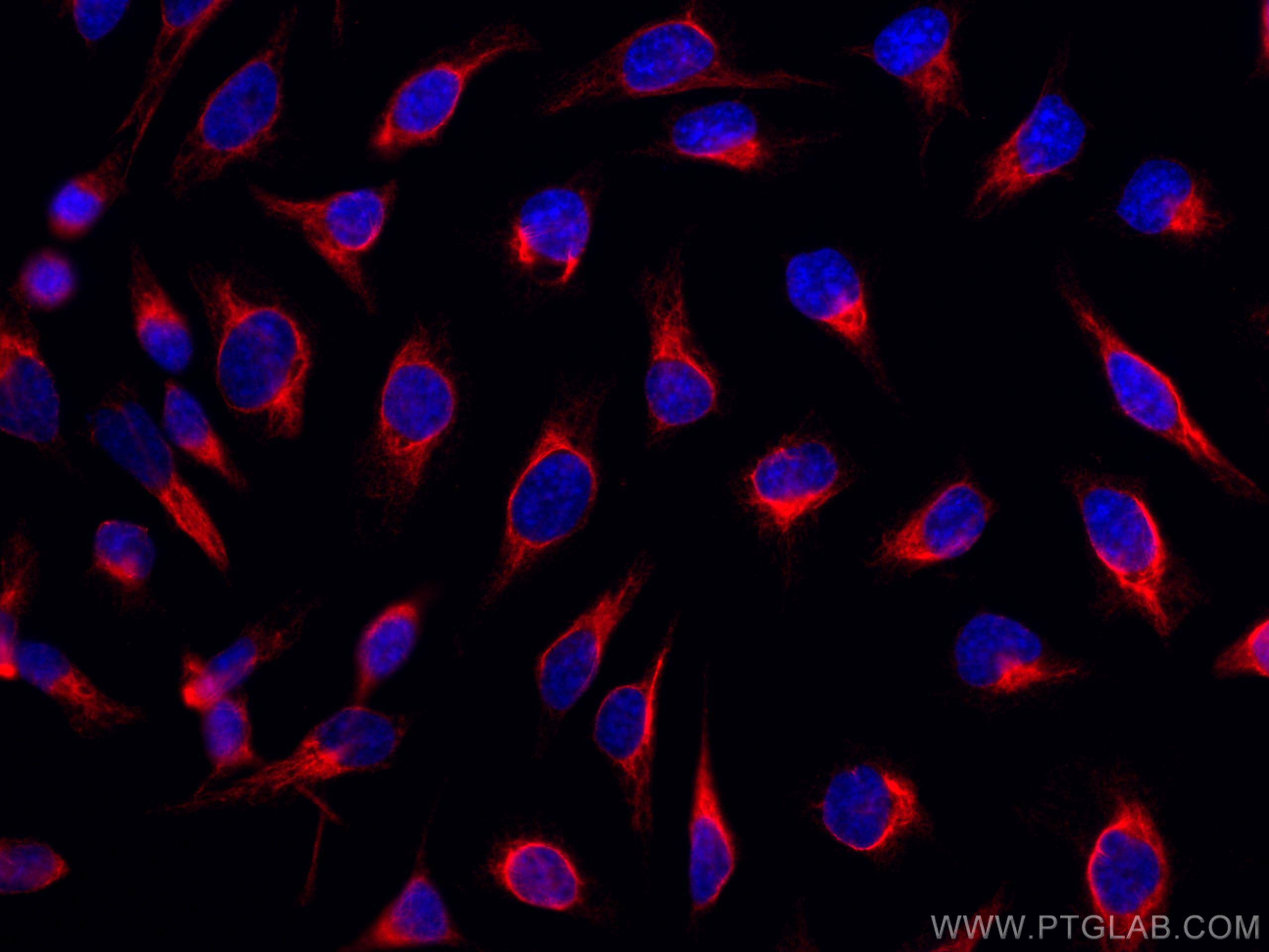 Immunofluorescence (IF) / fluorescent staining of HeLa cells using CoraLite®594-conjugated LAP3 Monoclonal antibody (CL594-66417)