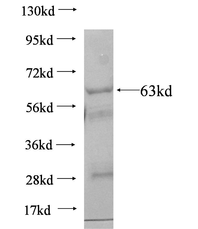 LAP3 fusion protein Ag6205 SDS-PAGE