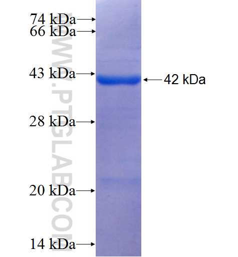 LAP3 fusion protein Ag6300 SDS-PAGE