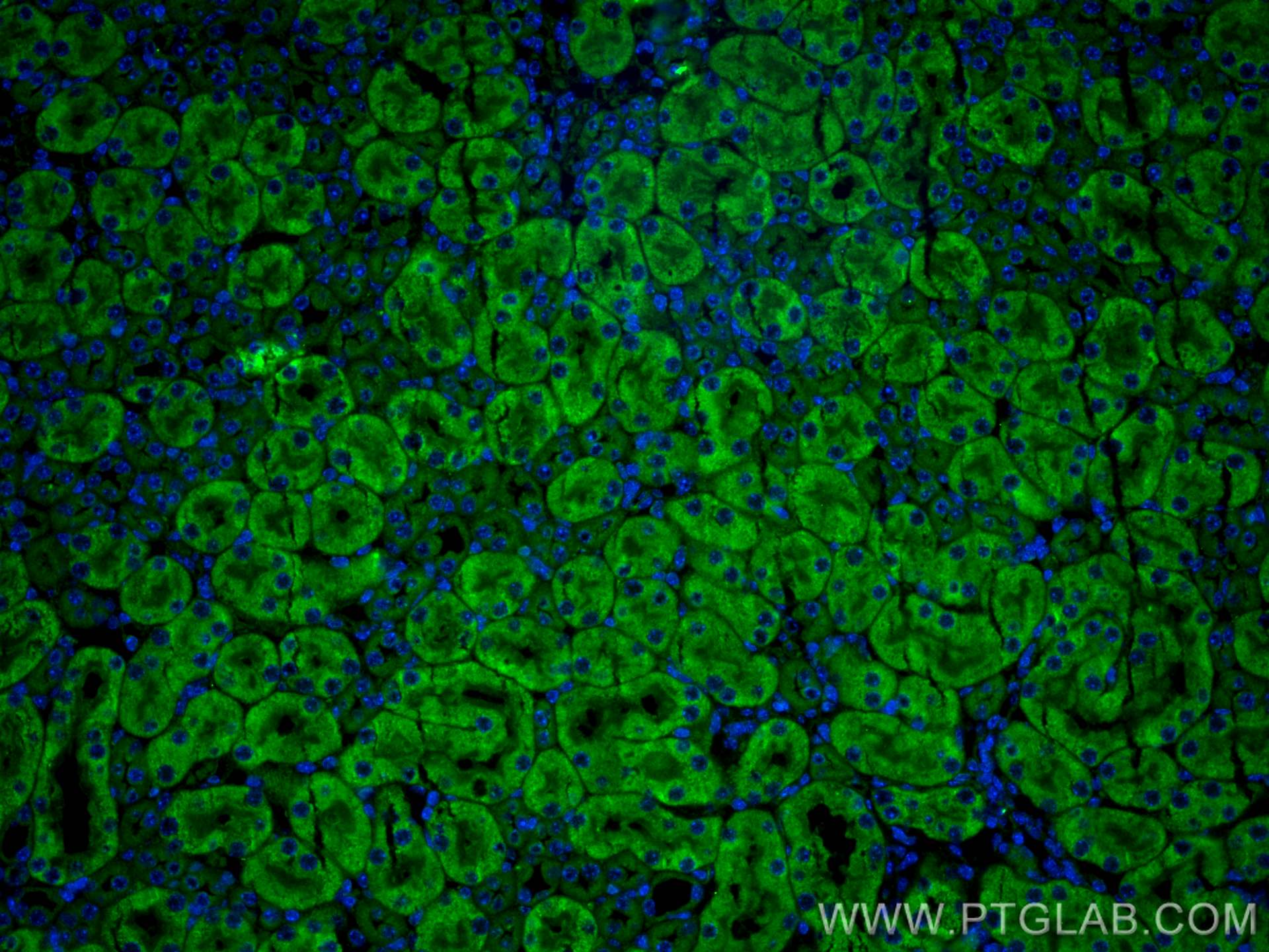Immunofluorescence (IF) / fluorescent staining of mouse kidney tissue using LAPTM4A Polyclonal antibody (30627-1-AP)