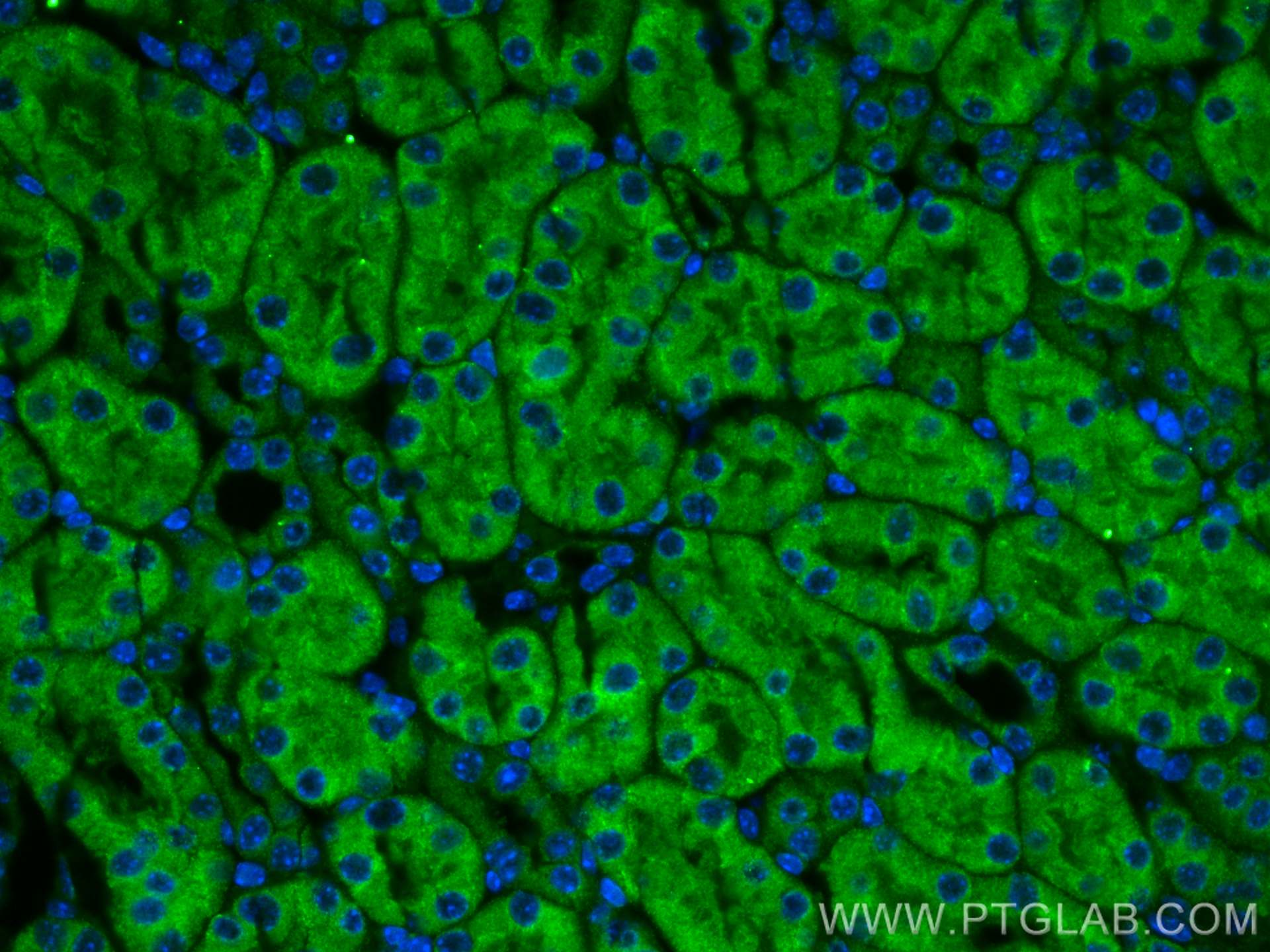 Immunofluorescence (IF) / fluorescent staining of mouse kidney tissue using LAPTM4A Polyclonal antibody (30627-1-AP)