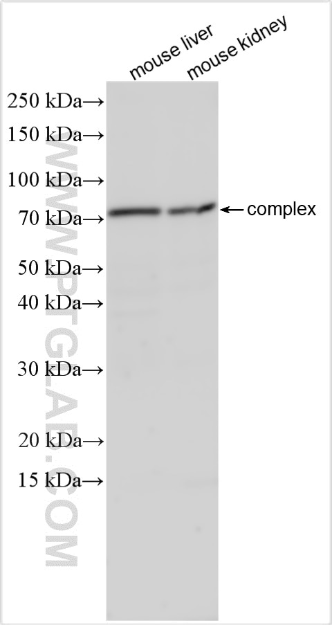 Western Blot (WB) analysis of various lysates using LAPTM4A Polyclonal antibody (30627-1-AP)