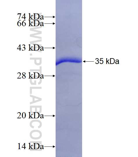 LAPTM4A fusion protein Ag25332 SDS-PAGE