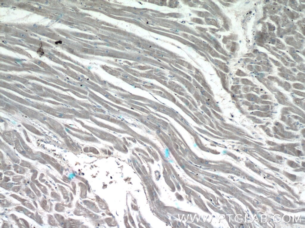 IHC staining of human heart using 18895-1-AP