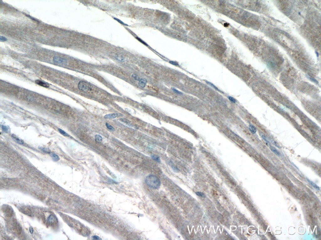 Immunohistochemistry (IHC) staining of human heart tissue using LAPTM4B Polyclonal antibody (18895-1-AP)