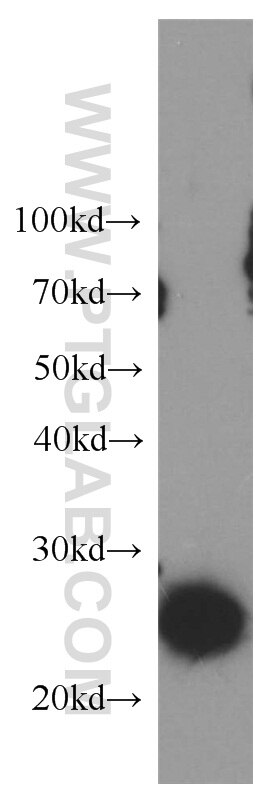 Western Blot (WB) analysis of rat lymph tissue using LAPTM4B Polyclonal antibody (18895-1-AP)