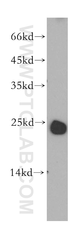 Western Blot (WB) analysis of mouse lymph tissue using LAPTM4B Polyclonal antibody (18895-1-AP)