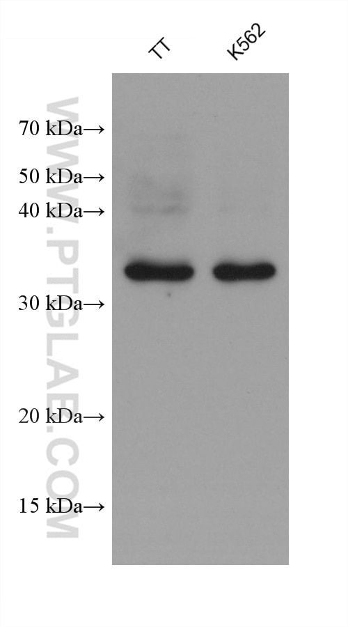 Western Blot (WB) analysis of various lysates using LAPTM4B Monoclonal antibody (68981-3-Ig)