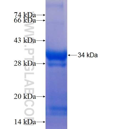 LAPTM4B fusion protein Ag13521 SDS-PAGE