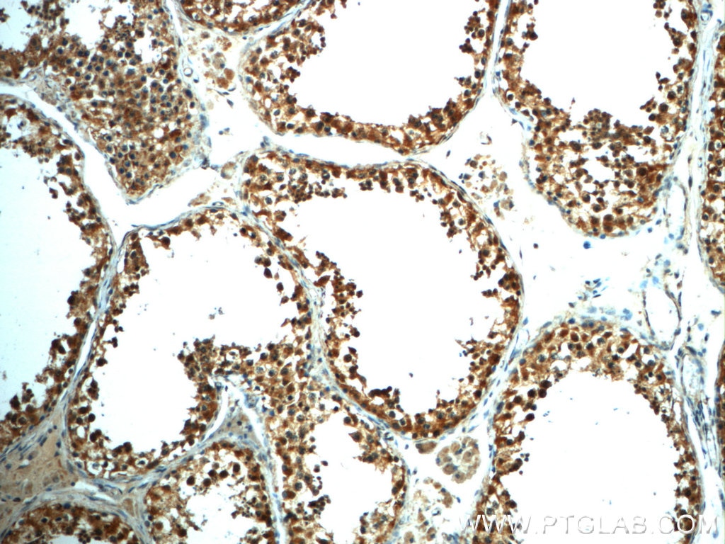 Immunohistochemistry (IHC) staining of human testis tissue using LARG Polyclonal antibody (22441-1-AP)