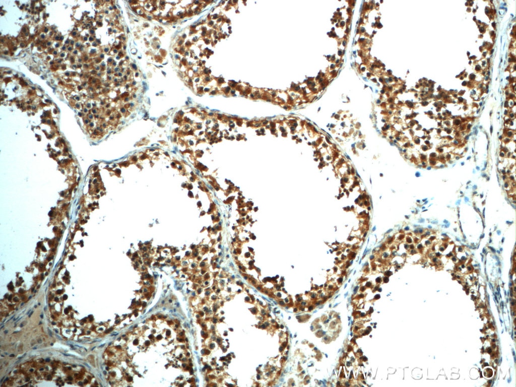 IHC staining of human testis using 22441-1-AP