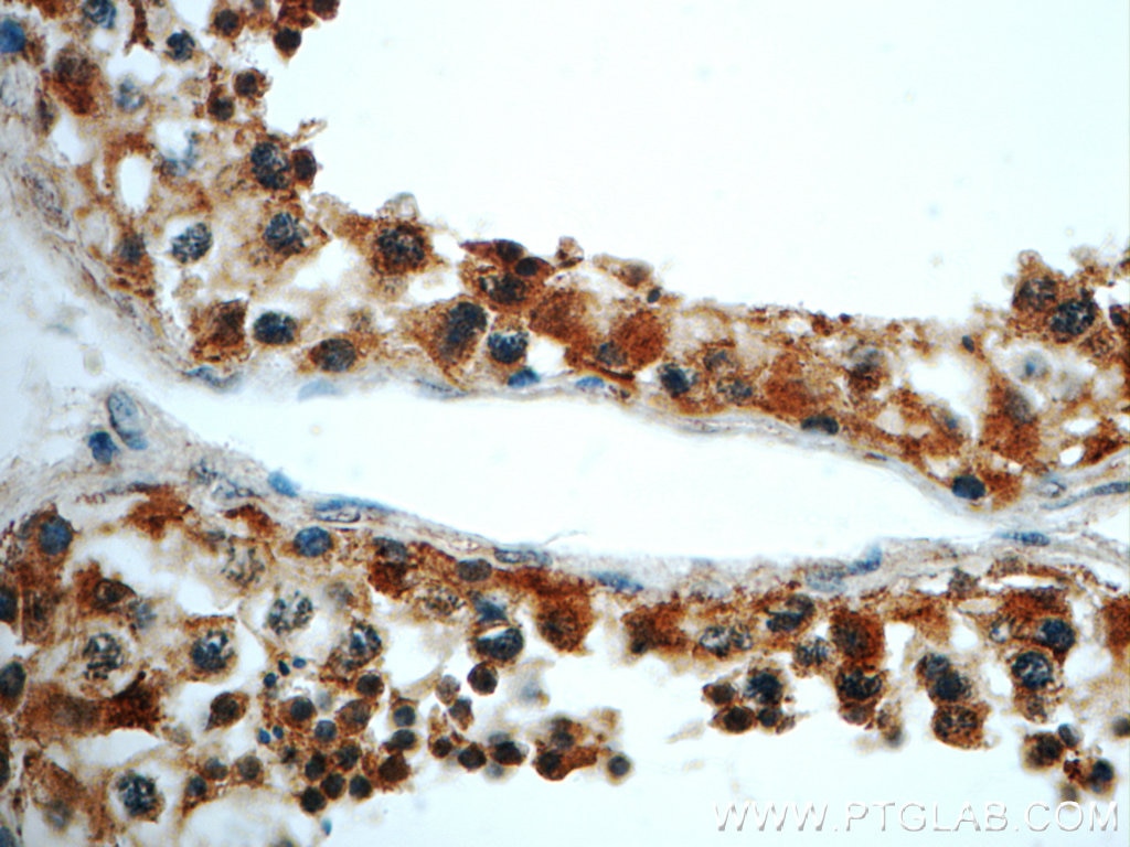 Immunohistochemistry (IHC) staining of human testis tissue using LARG Polyclonal antibody (22441-1-AP)