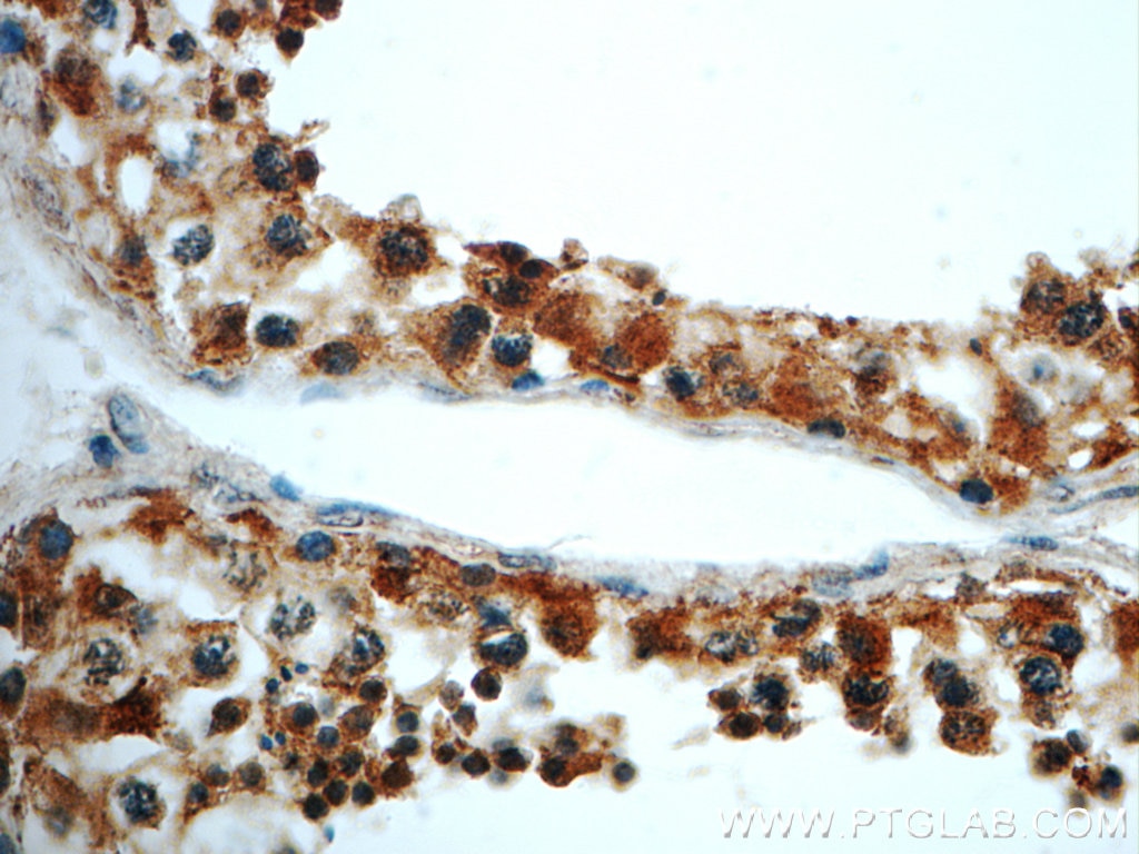 IHC staining of human testis using 22441-1-AP