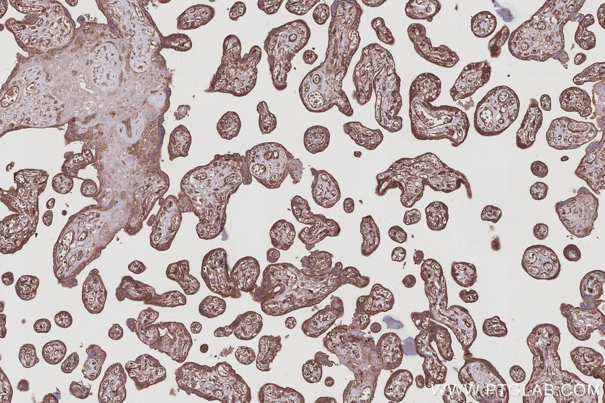 IHC staining of human placenta using 22441-1-AP Immunohistochemistry (IHC) staining of human placenta tissue using LARG Polyclonal antibody (22441-1-AP)