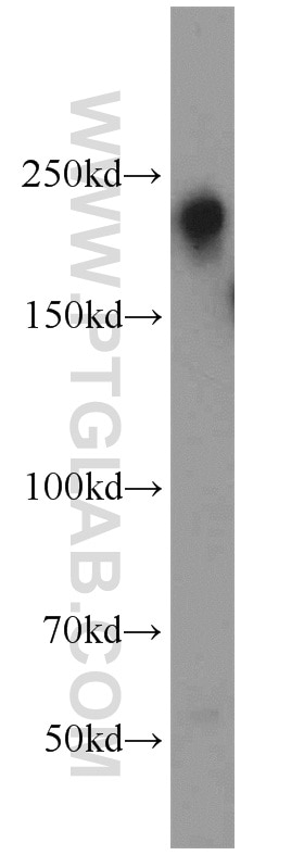 Western Blot (WB) analysis of HeLa cells using LARG Polyclonal antibody (22441-1-AP)