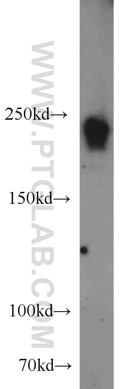 Western Blot (WB) analysis of Jurkat cells using LARG Polyclonal antibody (22441-1-AP)