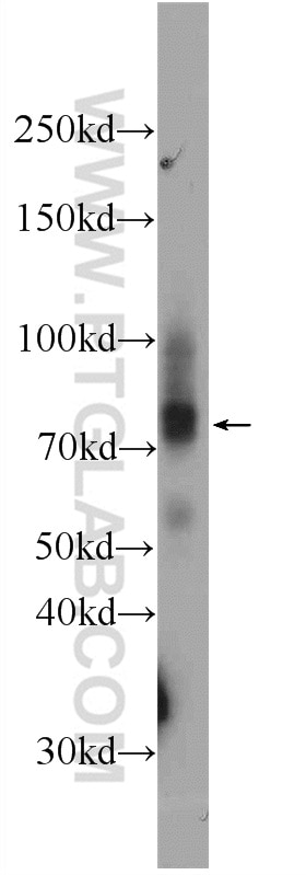 Western Blot (WB) analysis of mouse skeletal muscle tissue using LARGE Polyclonal antibody (24307-1-AP)