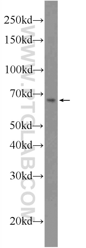 Western Blot (WB) analysis of NIH/3T3 cells using LARGE Polyclonal antibody (24307-1-AP)