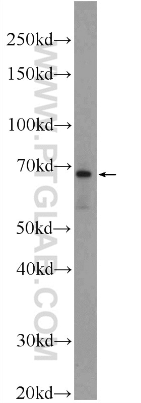Western Blot (WB) analysis of mouse kidney tissue using LARGE Polyclonal antibody (24307-1-AP)
